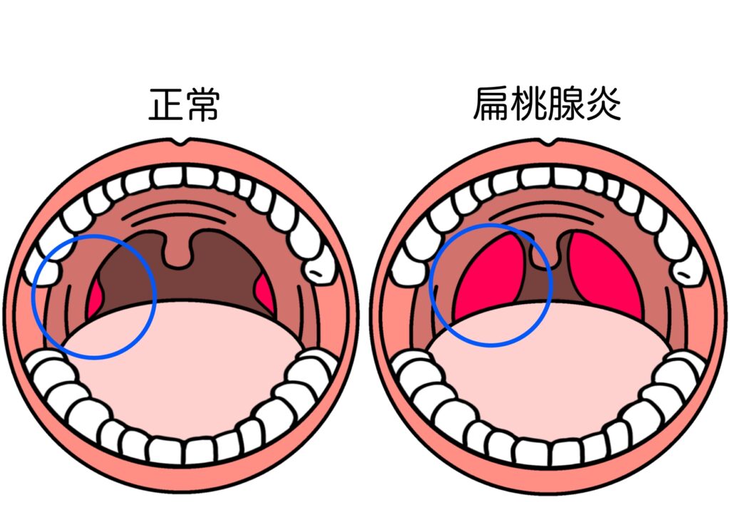 受け口に悩む人物のイメージ