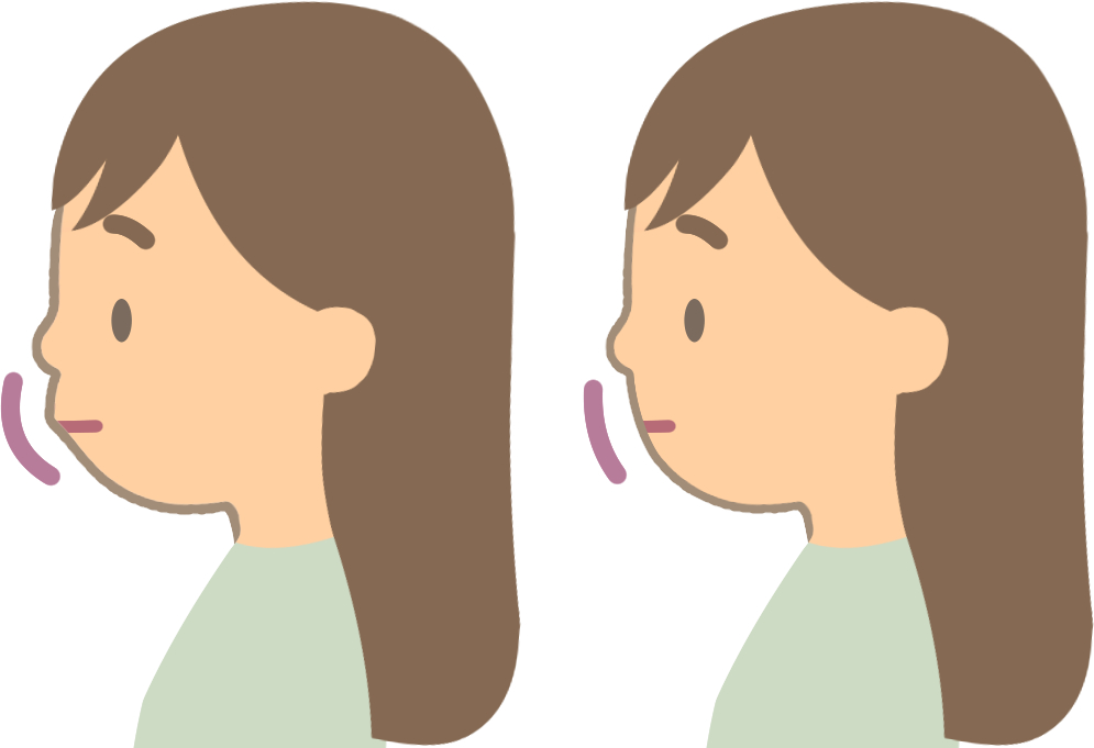 出っ歯に悩む人物のイメージ