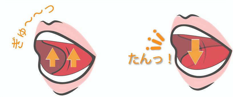 子どもの矯正治療のイメージ
